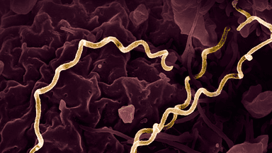 Syphilis and gonorrhoea rates jump among young Australians