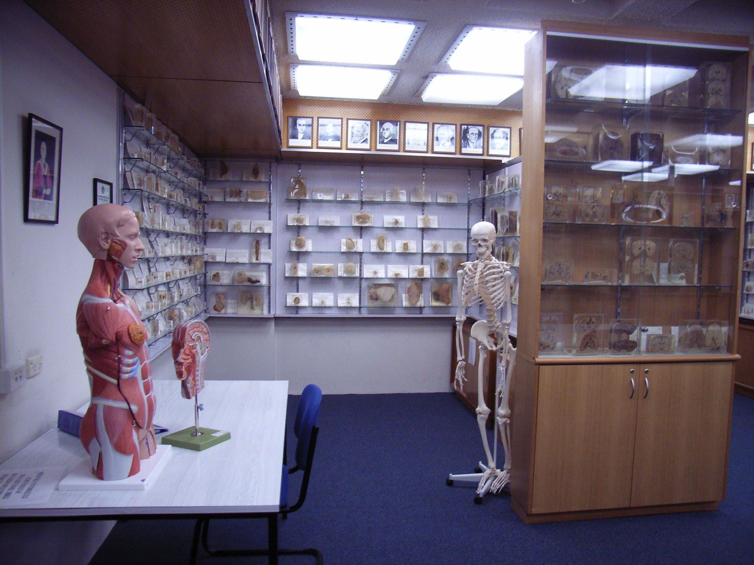 Almost 200 samples of human remains were kept in a museum