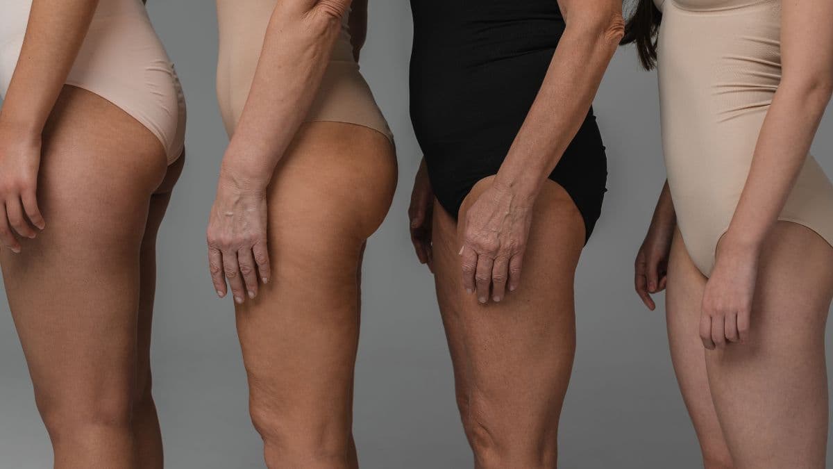 Labia surgery on the rise with feelings of shame