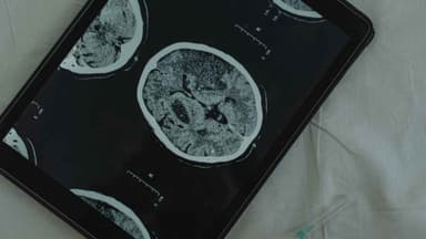 CTE found in domestic violence victims