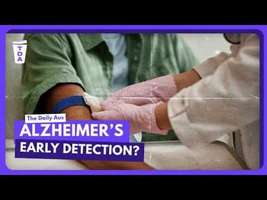 Can a blood test detect Alzheimer's early?